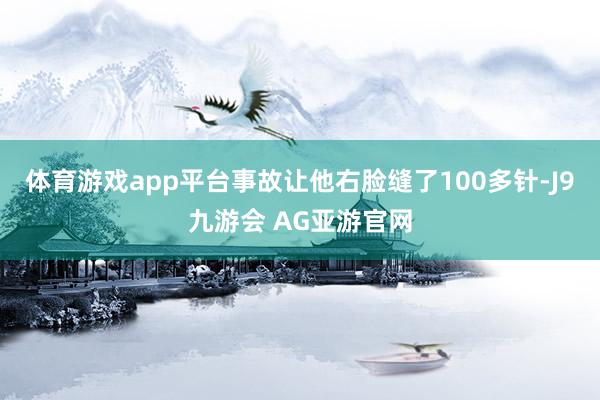 体育游戏app平台事故让他右脸缝了100多针-J9九游会 AG亚游官网